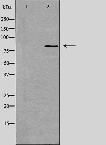 GIT2 Antibody