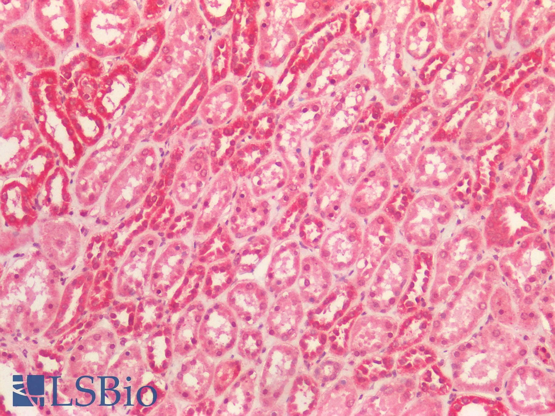 PathPlus™ Polyclonal Rabbit anti-Human IGF2 Antibody (IHC, WB)