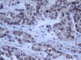 Monoclonal Mouse anti-Human DDX59 Antibody (clone OTI2G1, IHC, WB)