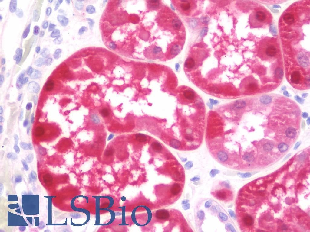 IHC-plus™ Polyclonal Rabbit anti-Human GSTA2 Antibody (aa1-196, IHC, WB)