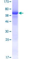Human GDPGP1 / C15orf58 Protein (Recombinant GST)