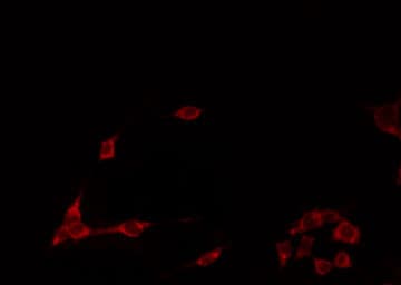 ARRDC1 Antibody