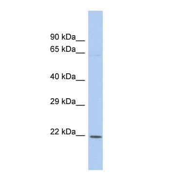 KLF3 Antibody (aa159-208)