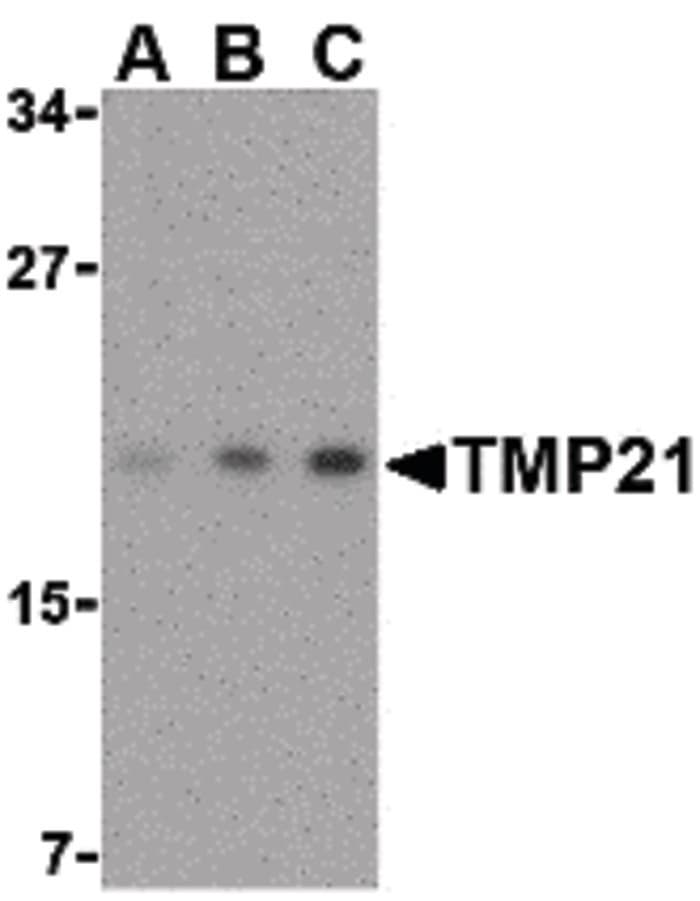 IHC-plus™ TMED10 / TMP21 Antibody