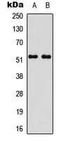 STEAP4 Antibody (Internal)