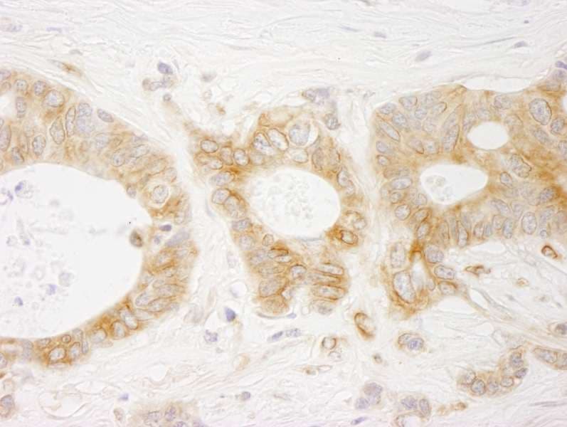 EML4 Antibody (aa150-200)