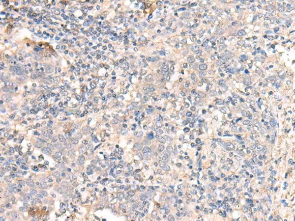 PARS2 Antibody