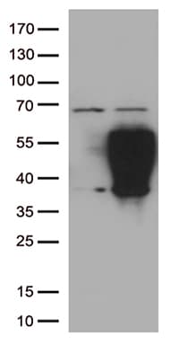 PD-L2 / PDCD1LG2 / CD273 Antibody (clone UMAB224)