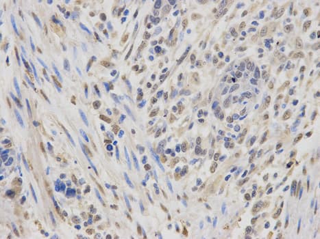 Polyclonal Rabbit anti-Human CRD-BP / ZBP1 / IGF2BP1 Antibody (IHC, IF, WB)