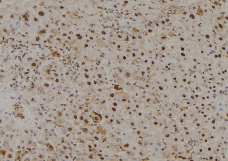 MYST3 / MOZ Antibody
