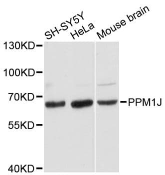 PPM1J Antibody