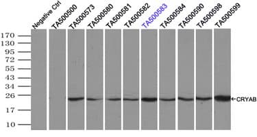 IHC-plus™ CRYAB / Alpha B Crystallin Antibody (clone 6D11)