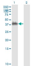 ANXA2 / Annexin A2 Antibody (clone 3E8-B6)