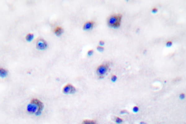 NTRK2 / TRKB Antibody (Val509)