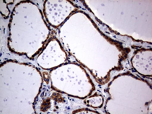 Monoclonal Mouse anti-Human DIRAS2 Antibody (clone OTI8A5, aa1-196, IHC, WB)