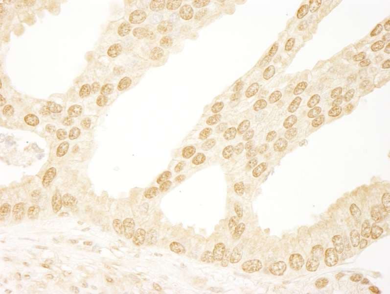 INTS6 Antibody (aa750-800)