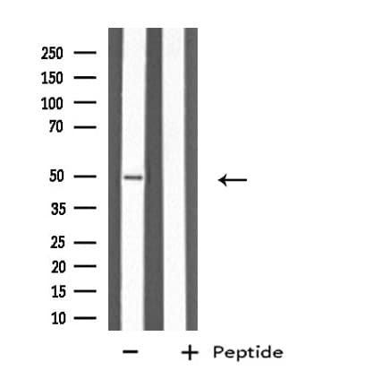 Polyclonal Rabbit anti-Human KRT37 + KRT38 Antibody (IF, WB)