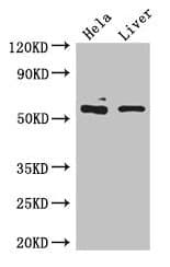 Polyclonal Rabbit anti-Human KRT81 / Keratin 81 / KRTHB1 Antibody