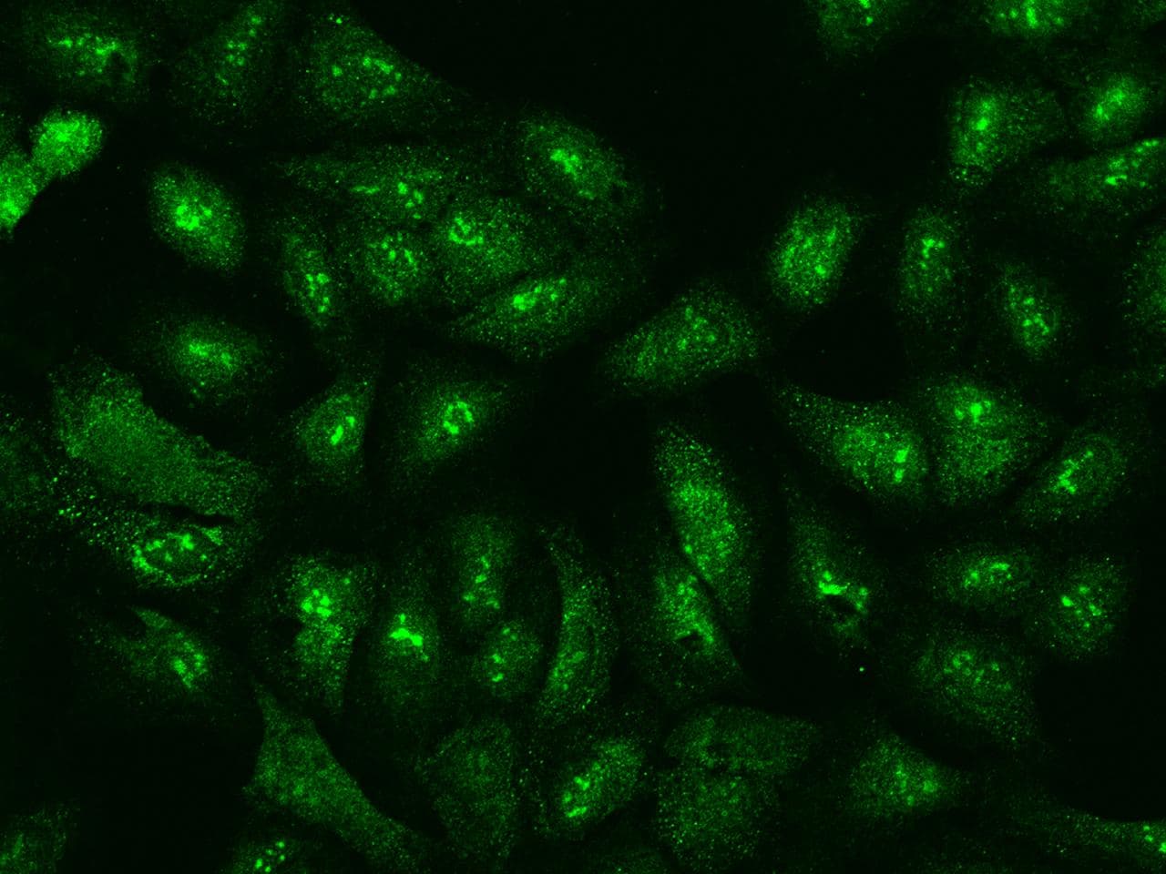 Polyclonal Rabbit anti-Human EIF3S5 / EIF3F Antibody (IHC, IF, WB)