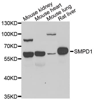 SMPD1 / Acid Sphingomyelinase Antibody (aa70-340)
