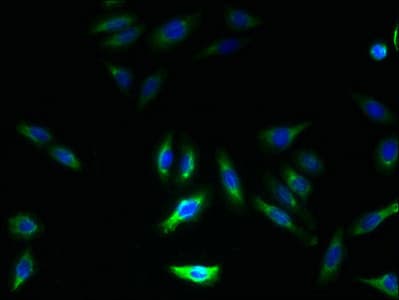 Polyclonal Rabbit anti-Human GHITM Antibody (IHC, WB)