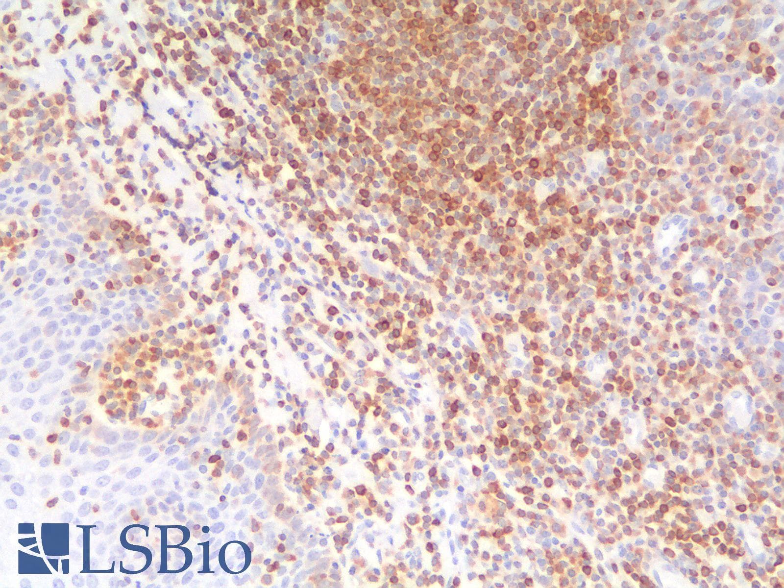 PathPlus™ BCL2 / Bcl-2 Antibody (clone BCL2/1878R)
