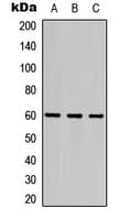 FZD4 / Frizzled 4 Antibody (Internal)