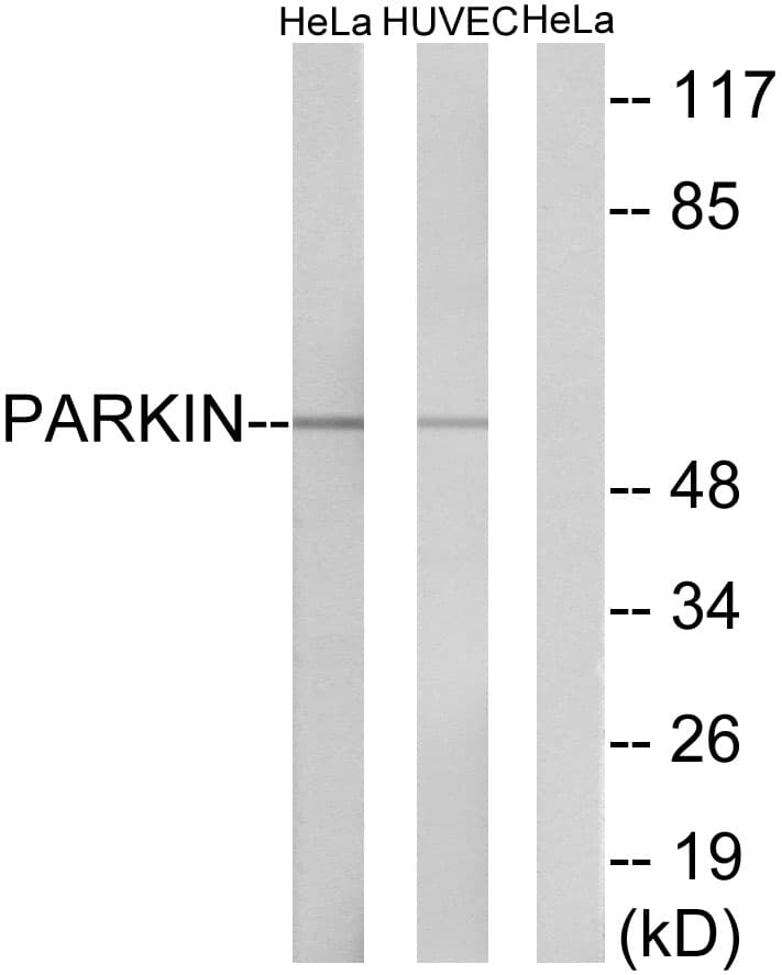 PARK2 / Parkin 2 Antibody (aa101-150)