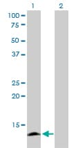 APOC4 / Apolipoprotein CIV Antibody (clone 3D10)