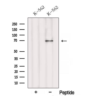 RPN1 / Ribophorin I Antibody