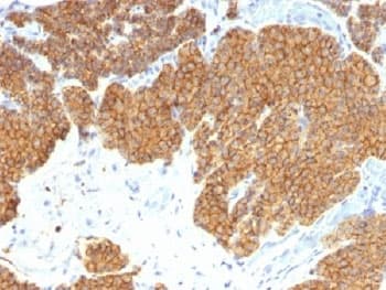 PTH / Parathyroid Hormone Antibody (aa1-34, clone 3H9)