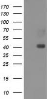 MAPRE2 / EB2 Antibody (clone OTI1A3)