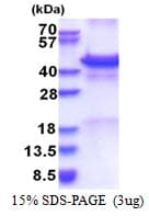 Human CALR3 Protein (Recombinant His)