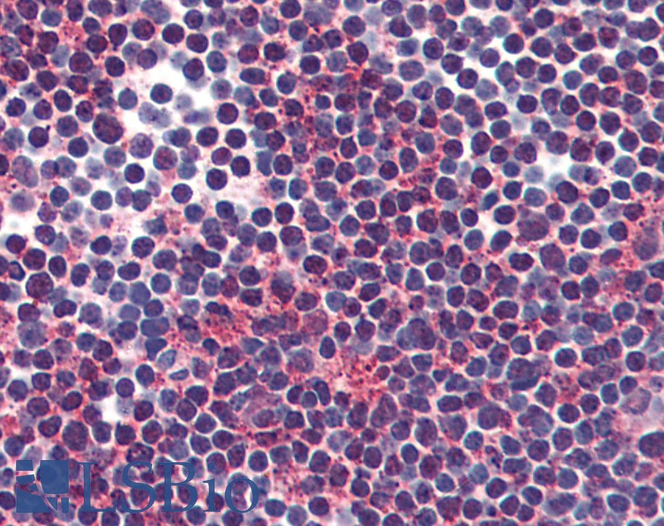 IHC-plus™ VPAC2 / VIPR2 Antibody (Internal)