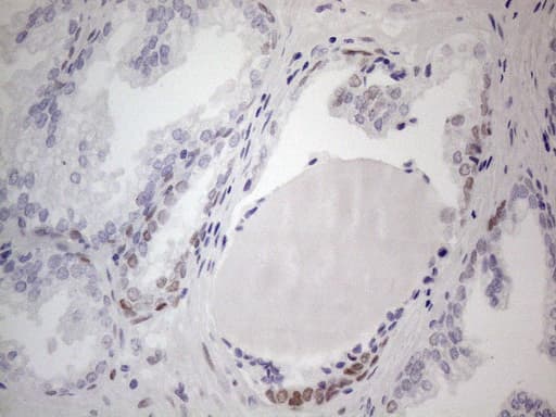 FOS / c-FOS Antibody (clone OTI1E3)