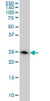 Monoclonal Mouse anti-Human DCXR Antibody (clone 6A6, IHC, WB)