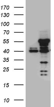 Monoclonal Mouse anti-Human NFKBIE / IKB Epsilon Antibody (clone OTI6D8, Carrier-free, WB)