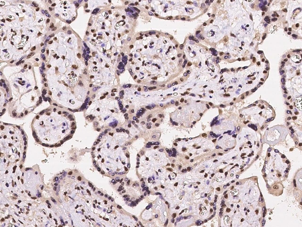 NMNAT1 / NMNAT Antibody