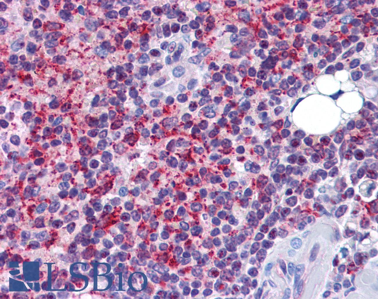 IHC-plus™ Polyclonal Rabbit anti-Human SH3RF2 Antibody (IHC, IF, WB)