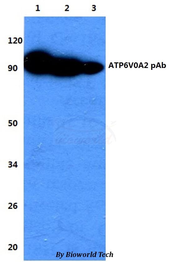 Polyclonal Rabbit anti-Human ATP6V0A2 Antibody (IHC, WB)