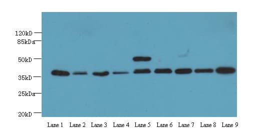 GAPDH Antibody