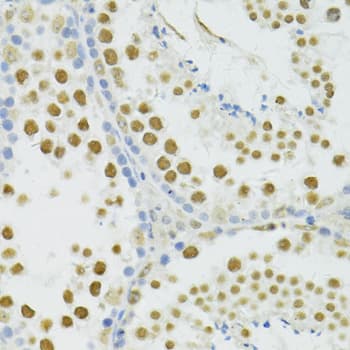 BRCA1 Antibody
