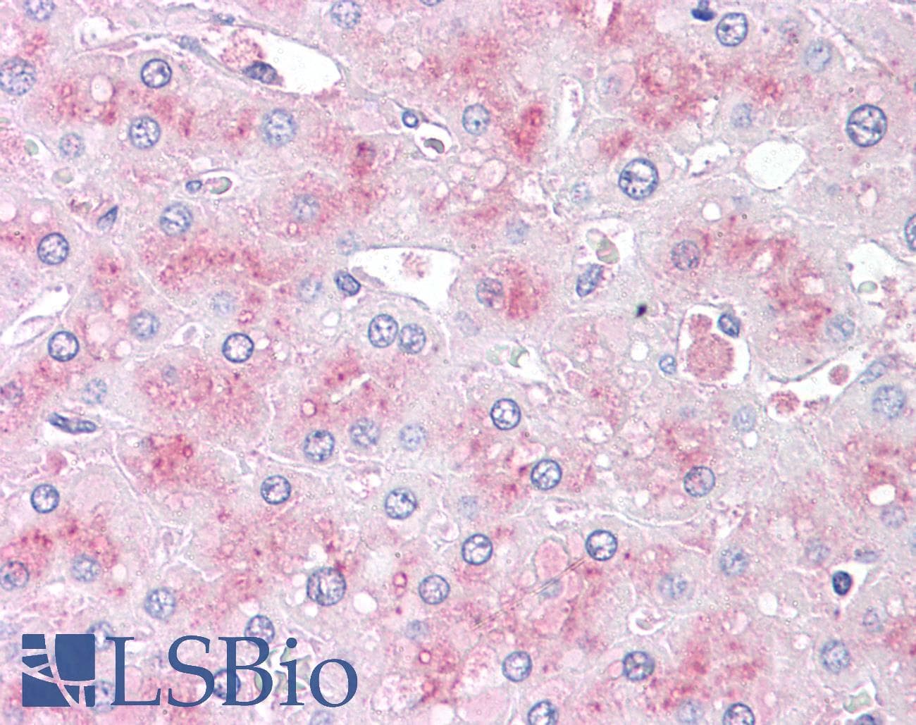 IHC-plus™ Polyclonal Rabbit anti-Human SLITRK6 Antibody (Internal, IHC)