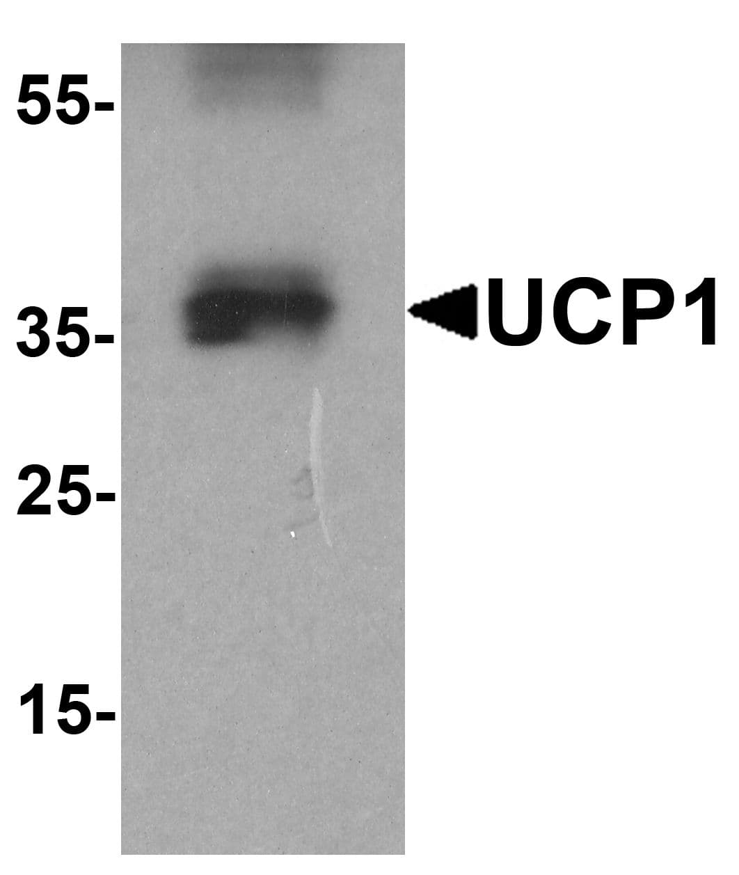 IHC-plus™ UCP1 / UCP-1 Antibody