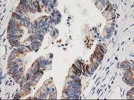 AK4 / Adenylate Kinase 4 Antibody (clone OTI2B12)