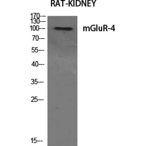 Polyclonal Rabbit anti-Human GRM4 / MGLUR4 Antibody (820-900 aa, C-terminal, IHC, WB)