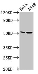 Polyclonal Rabbit anti-Human CHRDL1 Antibody (IHC, WB)