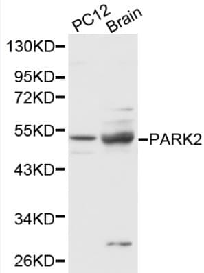 PARK2 / Parkin 2 Antibody