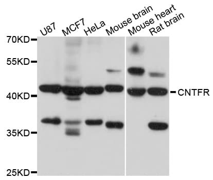 IHC-plus™ Polyclonal Rabbit anti-Human CNTFR Antibody (IHC, WB)