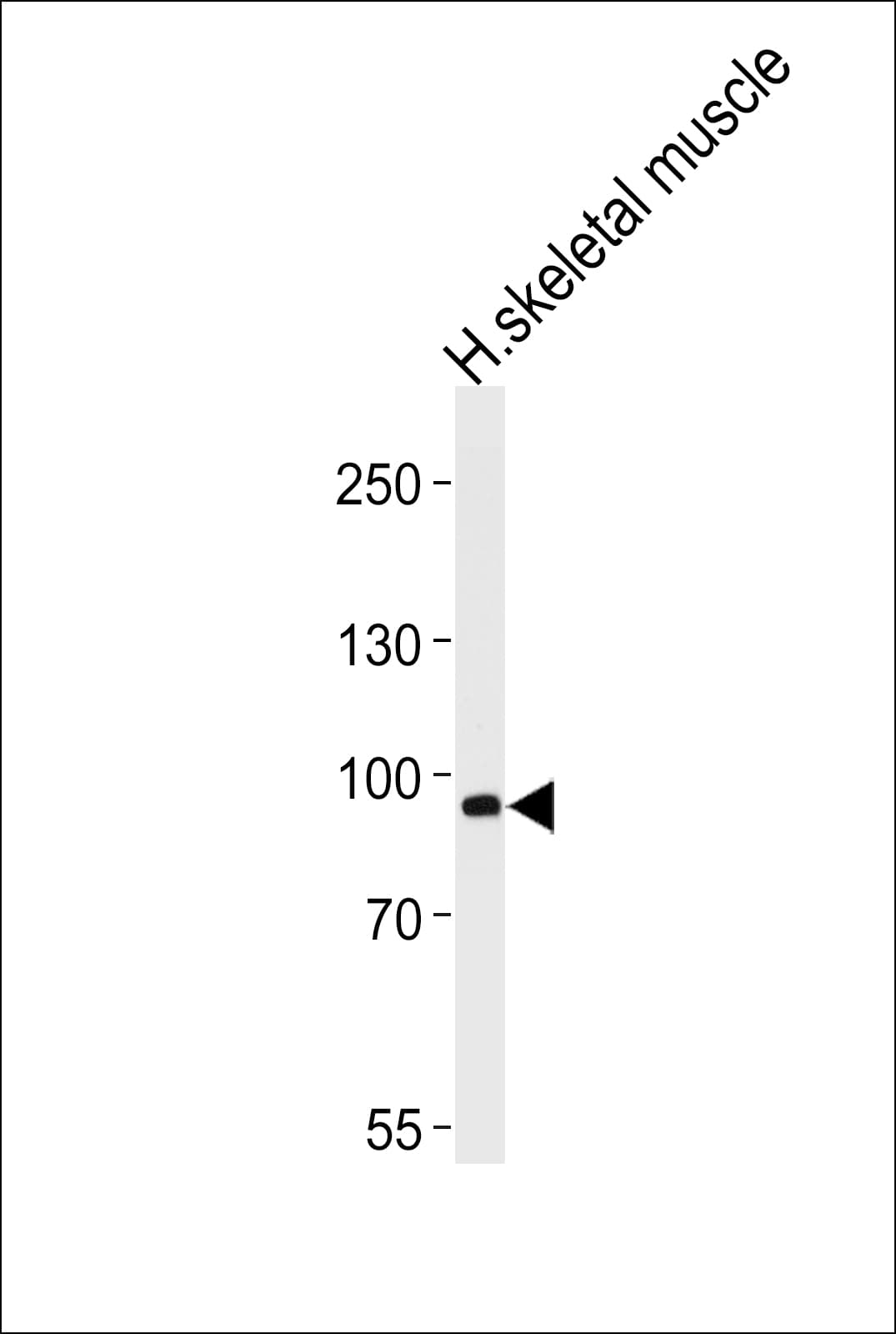 PFKM / PFK-1 Antibody (aa122-151)